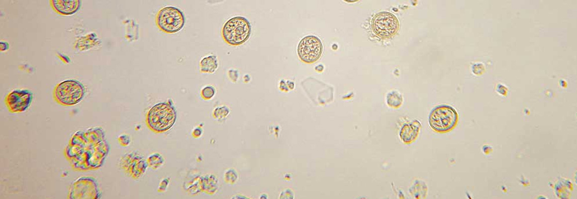 Der Einzeller Toxoplasma gondii unter dem Mikroskop.
