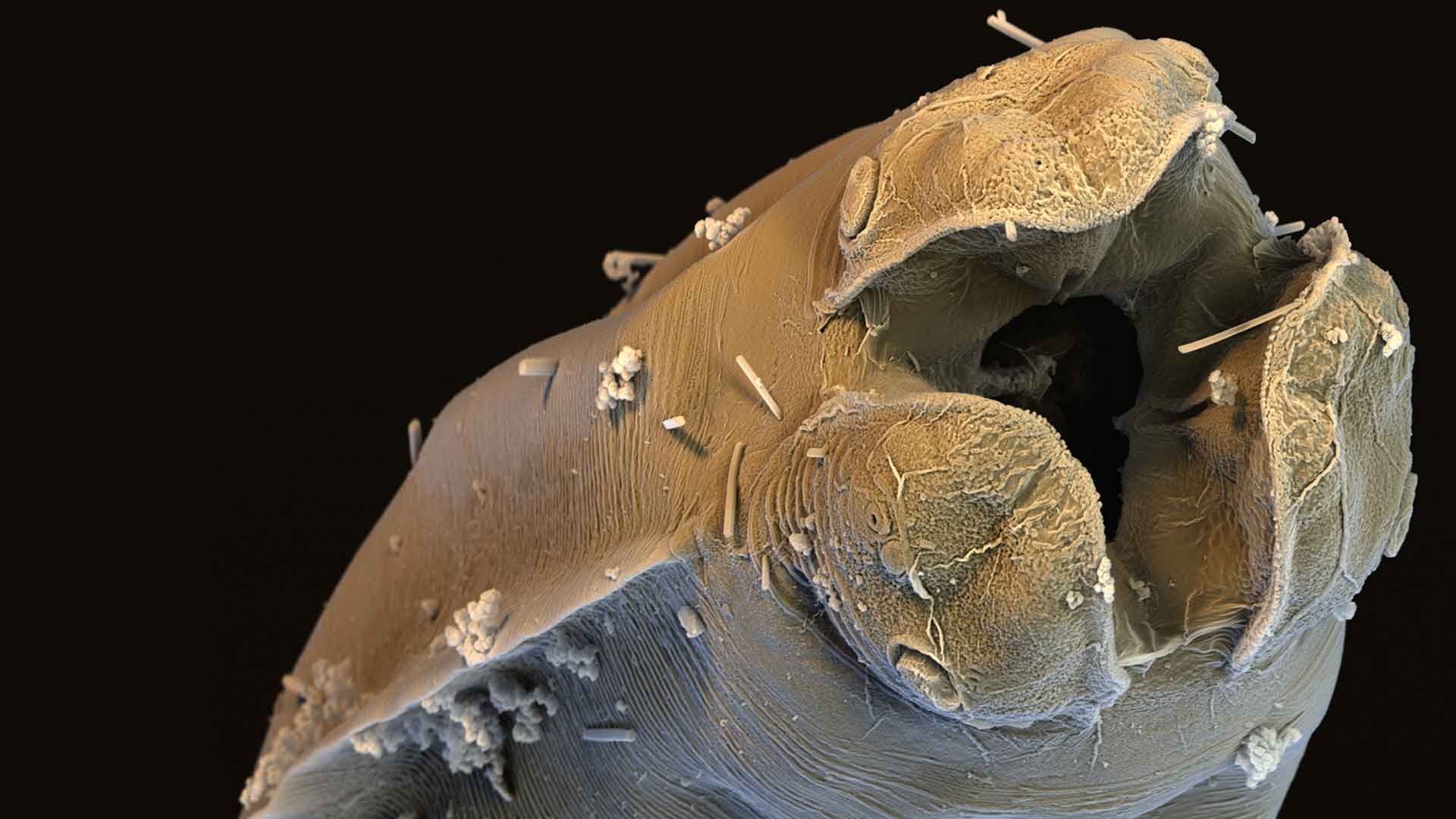 Wurm: Hundespulwurm unter einem Rasterelektronenmikroskop