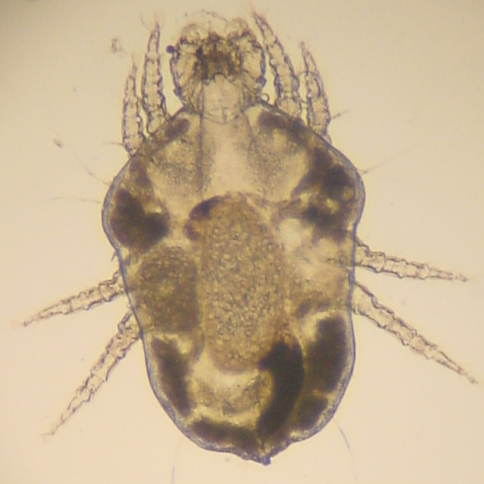 Eine Pelzmilbe unter dem Mikroskop (Bildquelle: Kalumet - German Wikipedia, CC BY-SA 3.0)
