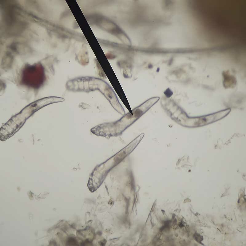 So sehen Demodex-Milben unter dem Mikroskop aus