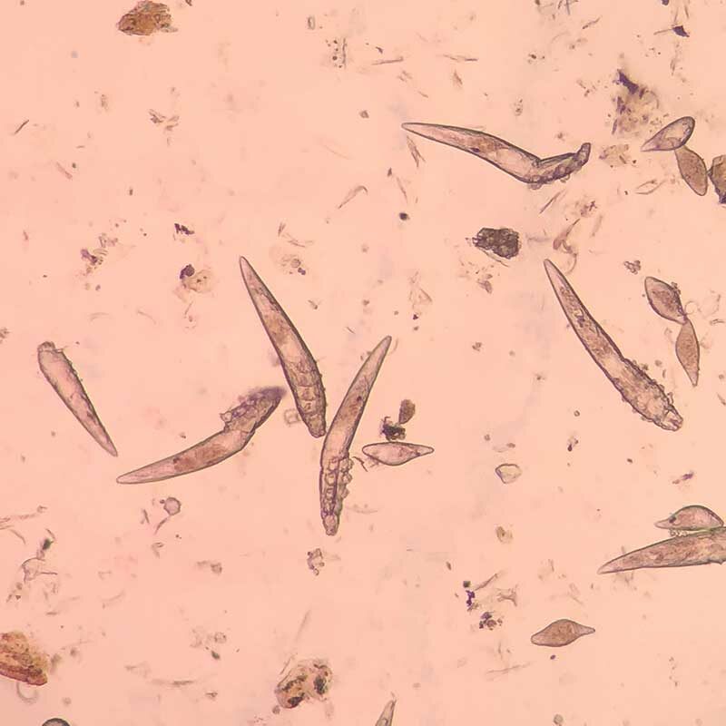 Demodex-Milben unter dem Mikroskop